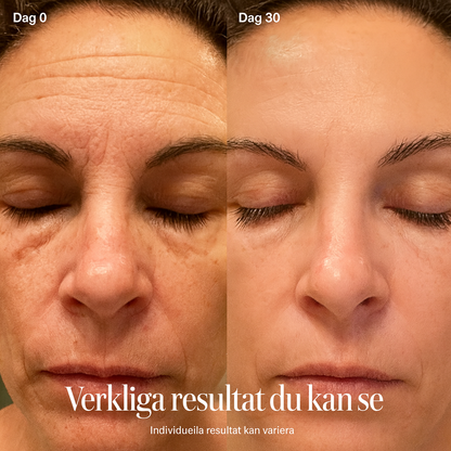 LUMÈRA RedGlow Therapy Wand